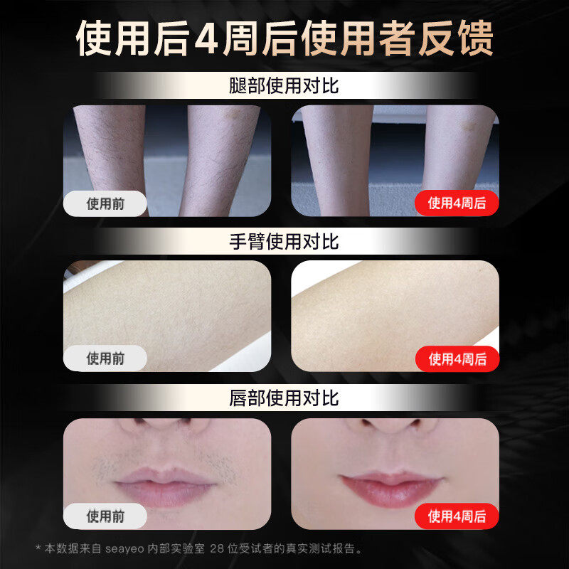  seayeo脱毛仪器