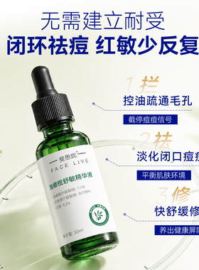 斐思妮油橄榄精华液次抛祛痘控油