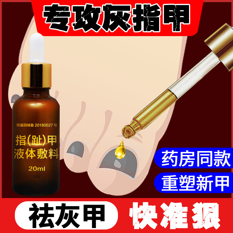 灰指甲甲沟炎去肉芽抑菌tm 淮南药之都大药房保健理疗