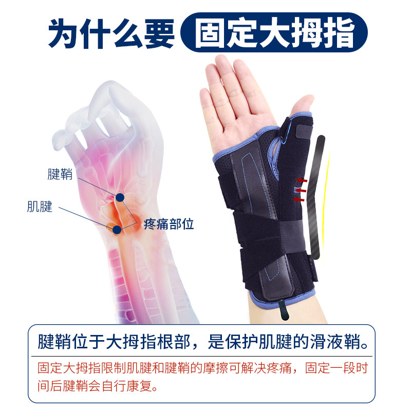 腱鞘炎医用妈妈手腕骨折拇指护腕 velpeau医疗器械护具（器械）