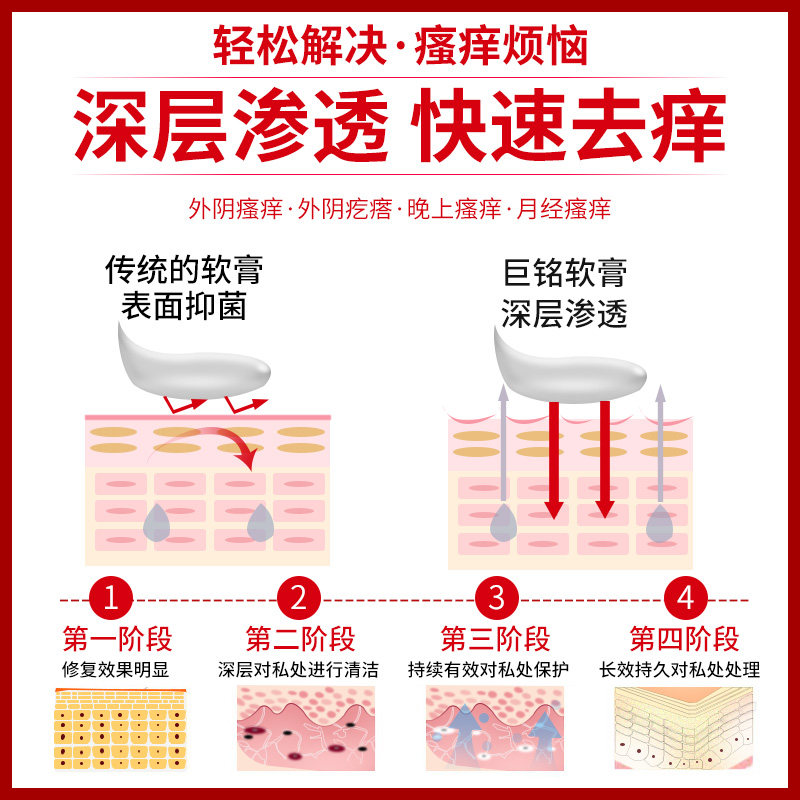 女私处抑菌护理洗剂外阴瘙痒止痒膏 三九利民保健品皮肤消毒护理（消）