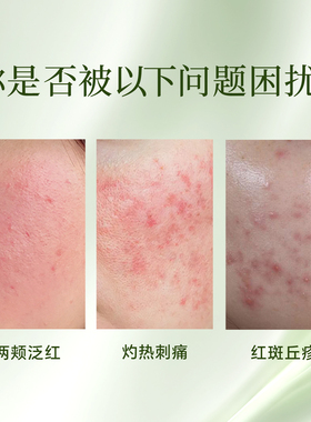 锐皙-甘草舒缓精华液护肤保湿套盒