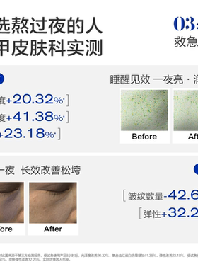 3点回血面膜免洗入睡睡眠面膜