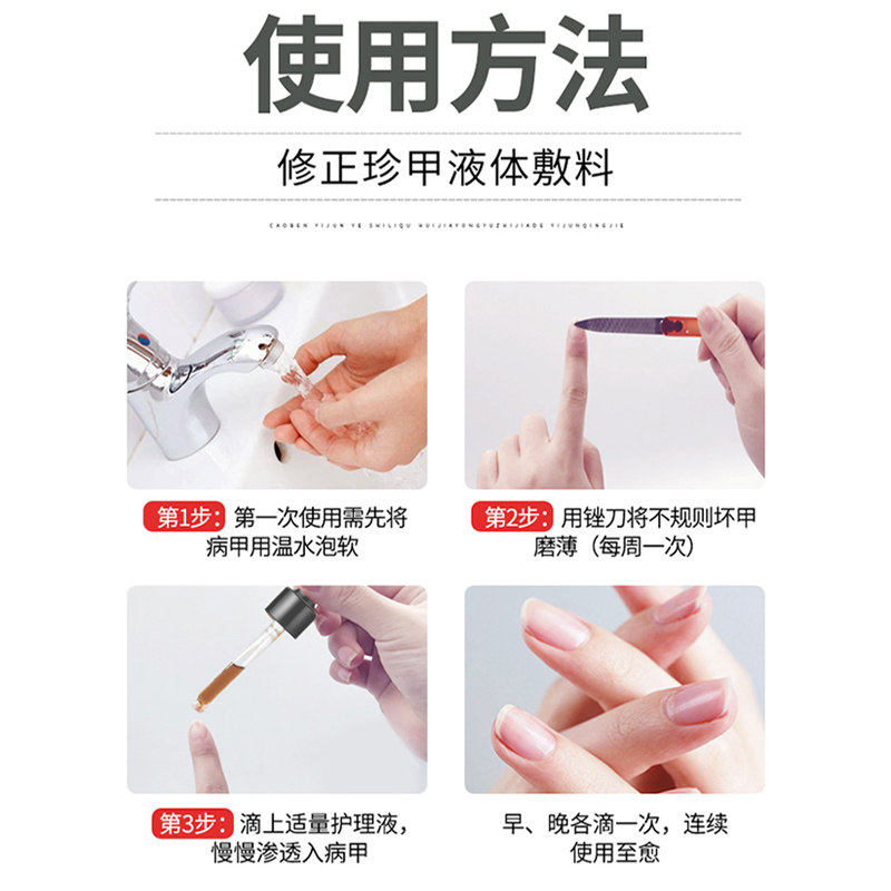 修正灰指甲治疗正品旗舰店抑菌液 国盛医疗器械保健理疗