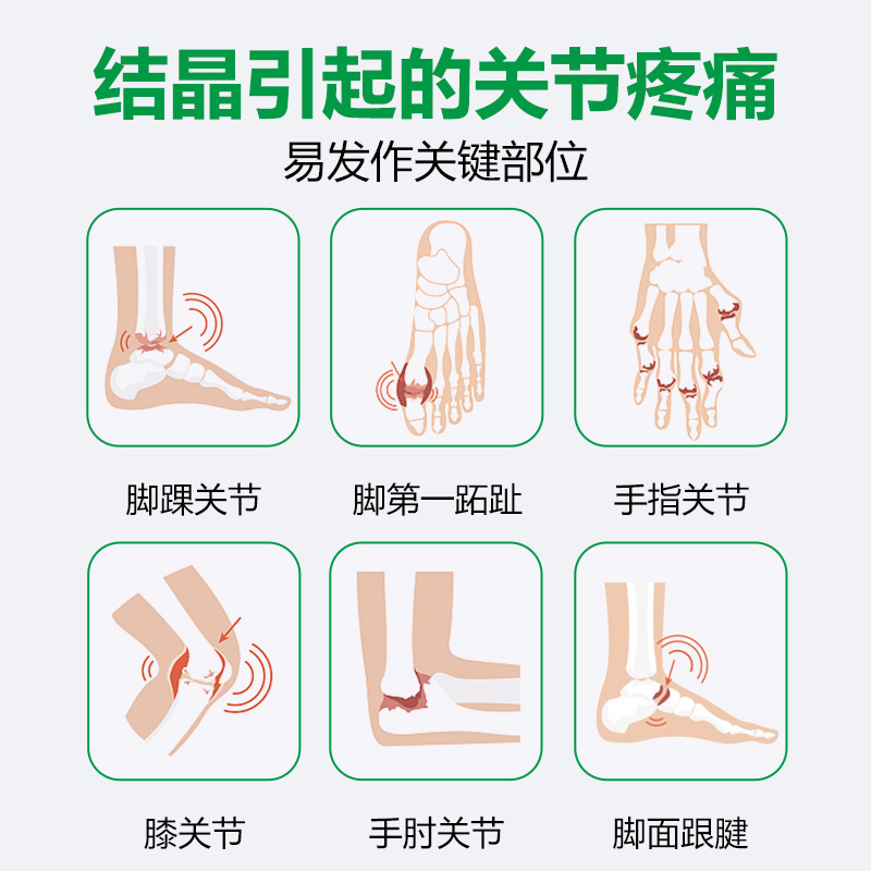 樂道 NOTO 尿酸通芹菜籽黑樱桃精华中老年人关节保健品西芹籽胶囊 - 图2