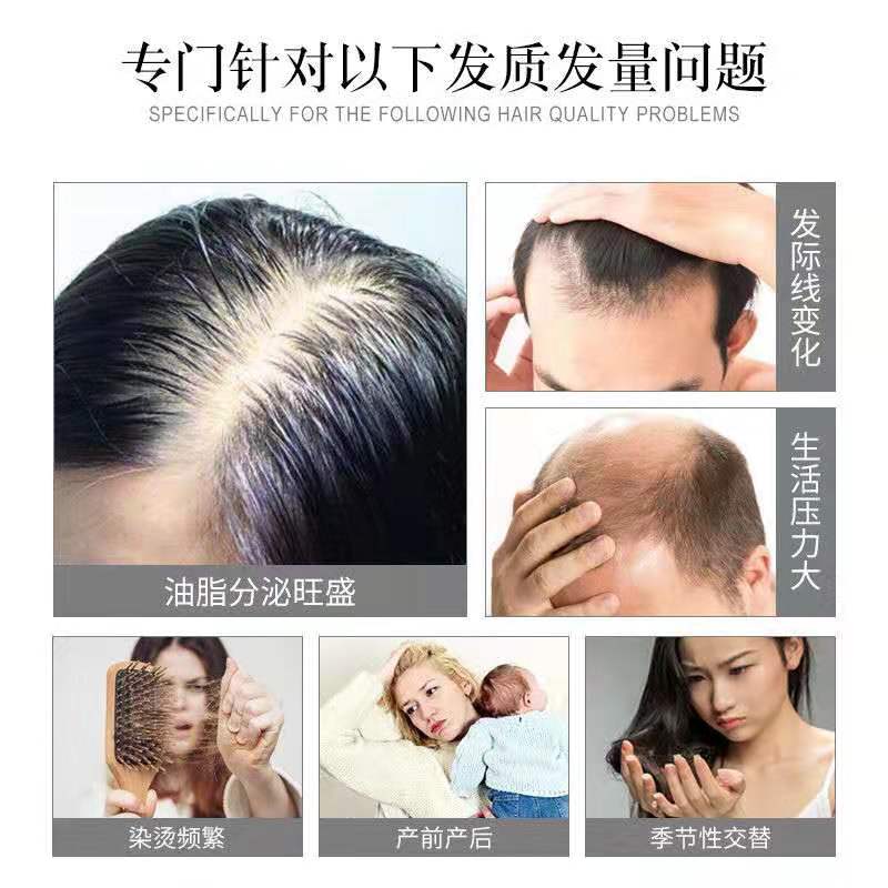 尊荣侧伯叶洗发水无硅油男女洗发露去头皮控油强根防掉发去屑止痒_虎窝淘
