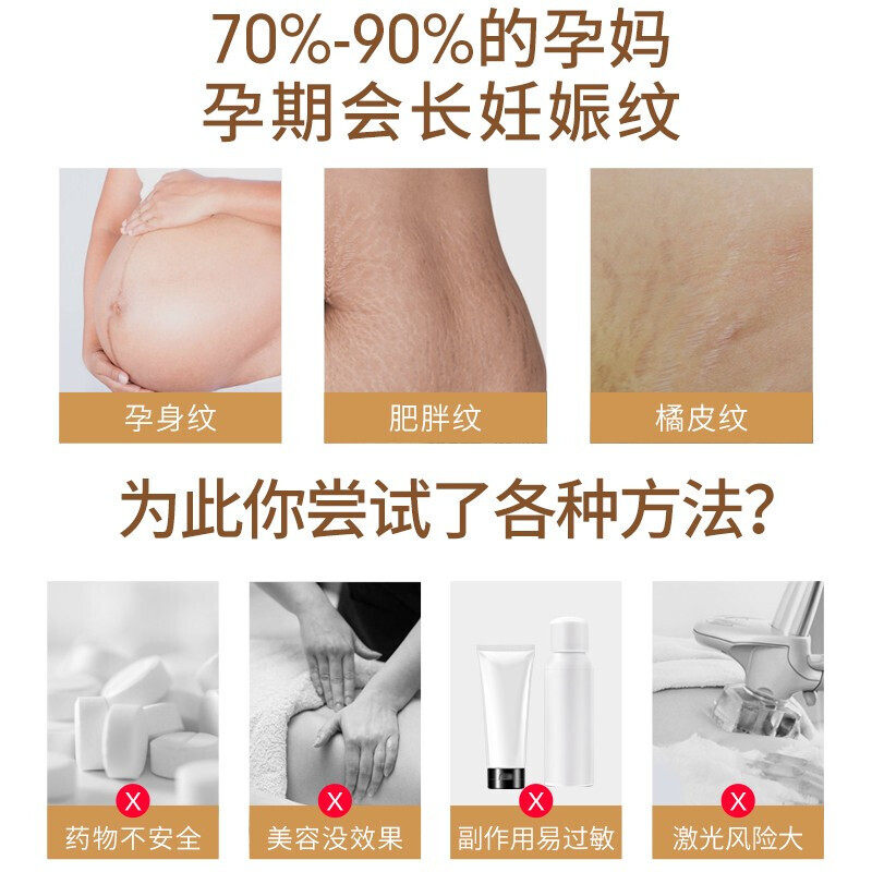 妊娠纹修复霜疤痕修复祛疤贴ys 肯芙洛祛疤产品