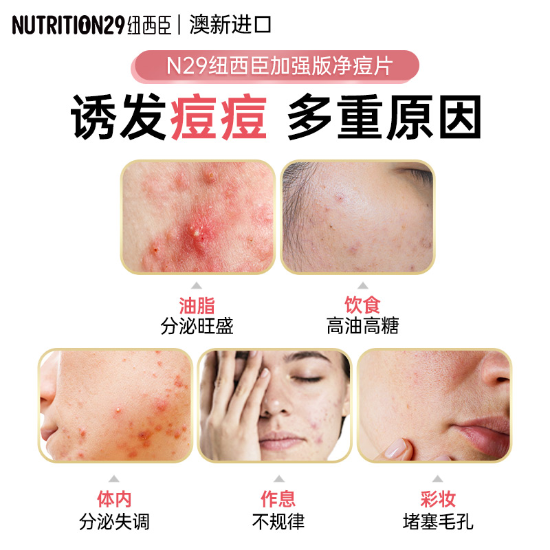澳洲N29纽西臣祛痘片内调维生素b族月见草维生素b6淡印vb旗舰店