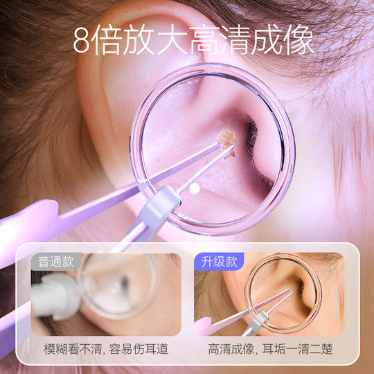 Beleuchteter Ohrlöffel, sichtbares Werkzeug zum Ohrpicken