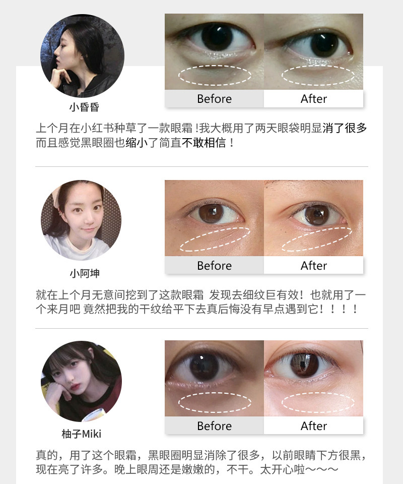 hopedense hd焕彩活性修复抗皱眼霜 hopedense眼霜