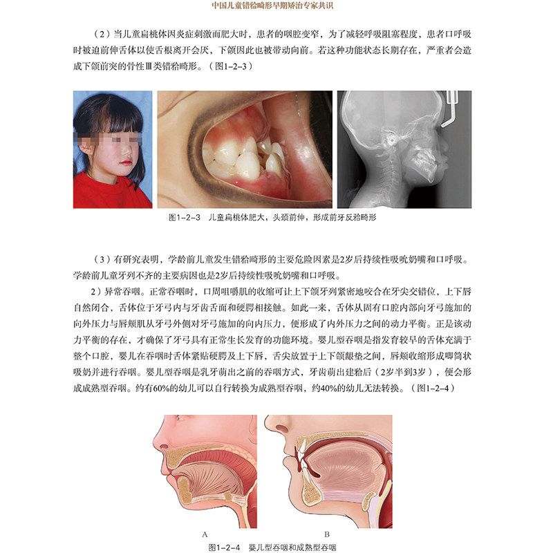 精装正版现货 中国儿童错颌畸形早期矫治专家共识及病例解析+当代儿童正畸矫治经典应用 口腔专业医学书籍 组合 李小兵著 华西口腔