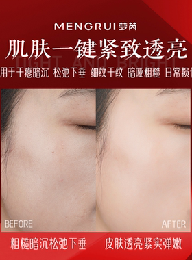 梦芮六胜肽抗皱红宝石面霜保湿滋润抗皱紧致补水脸部提拉紧致女
