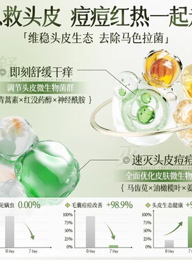 头皮修护滋养精华控油去屑