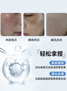 氨甲环酸湿敷液传明酸原液精华液淡化黑色素补水湿敷提亮肤色