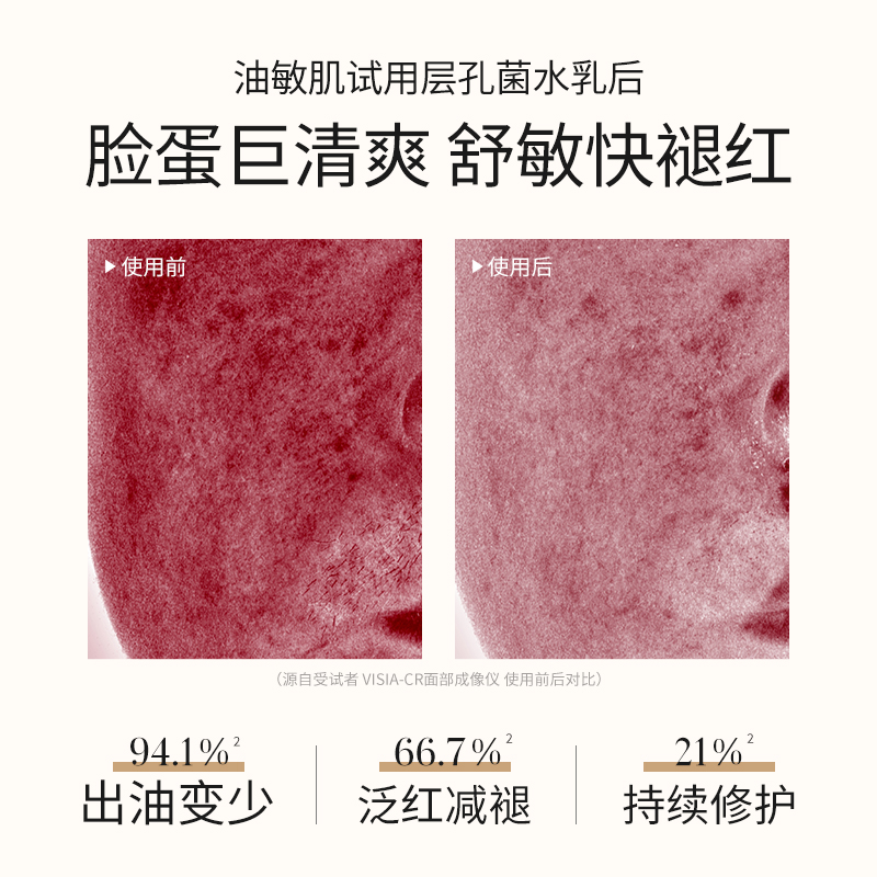 【粉丝专享】–溪木源层孔菌油敏肌水乳洁颜露旅行装控油