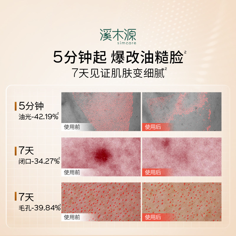 [618抢先购]溪木源层孔菌智控水油皮爽肤精华水敏肌控油补水喷雾