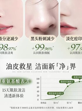 维特丝氨基酸祛痘控油美白洁面乳