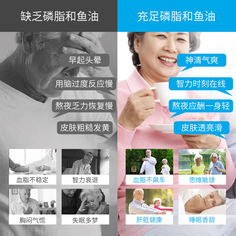 买2送1卵磷脂大豆磷脂康纽莱软胶囊 共赢保健食品鱼油/深海鱼油