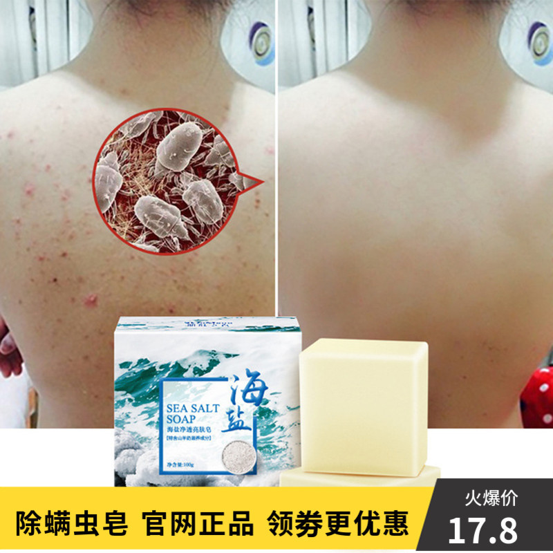 女生的心仪好物店可柏迷迭海盐皂日夜杀菌除螨背部后背蛮满虫皂除螨身体全身面部2