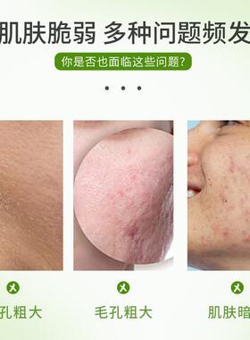 植护主义者儿童专用保湿面膜