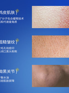 【药房同售】嫩肤去角质鸡皮