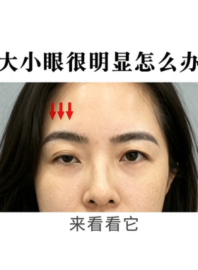 大小眼矫正器面瘫眼肌训练器