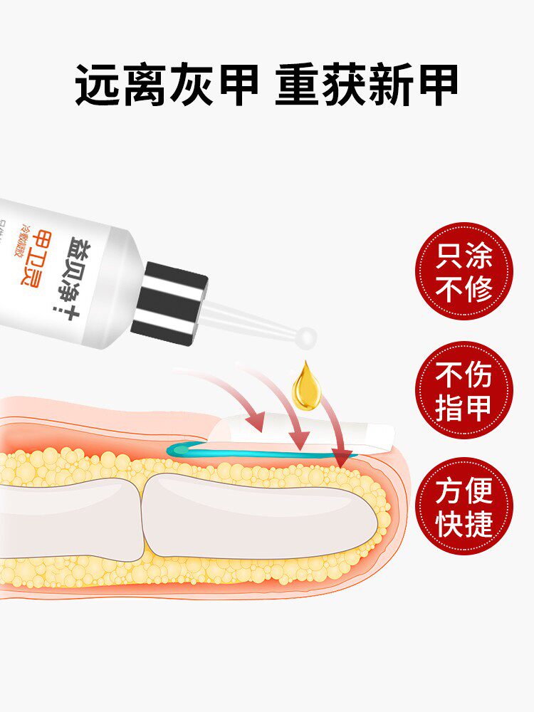 益贝净甲卫灵灰指甲旗舰店冷敷凝胶 益贝净保健理疗