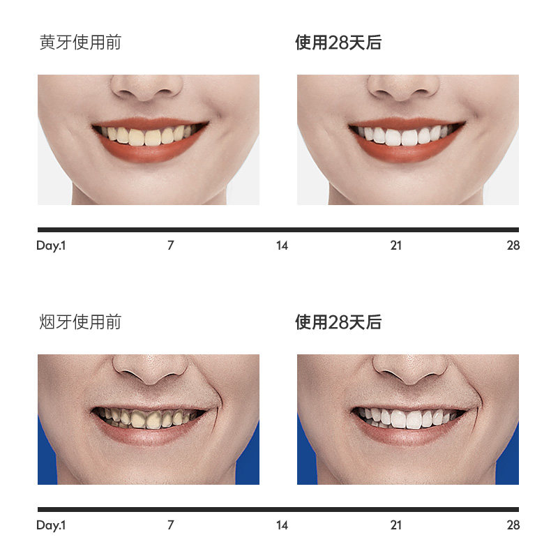 仁和去黄洗白牙渍速效去口臭洗牙粉 斯菲卡琳牙粉