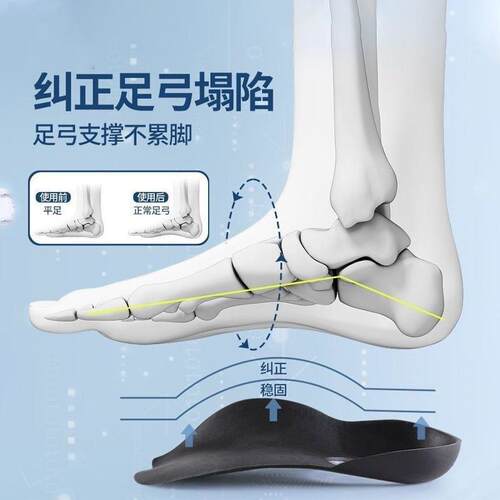 扁平足鞋垫足弓足外翻内八字平底o型腿矫形塌陷支撑平足神器定制 - 图0