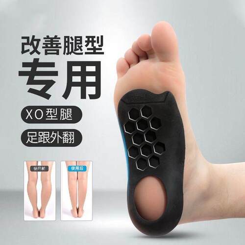 扁平足鞋垫足弓足外翻内八字平底o型腿矫形塌陷支撑平足神器定制 - 图1