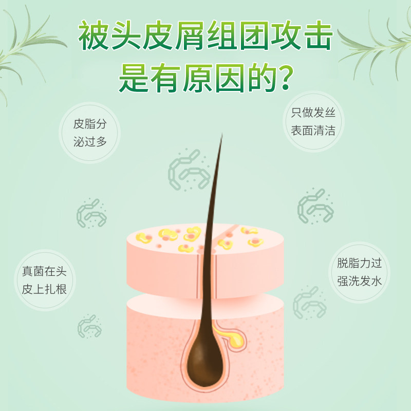 爱洛薇茶树油去屑头皮控油沐浴露 爱洛薇洗发水