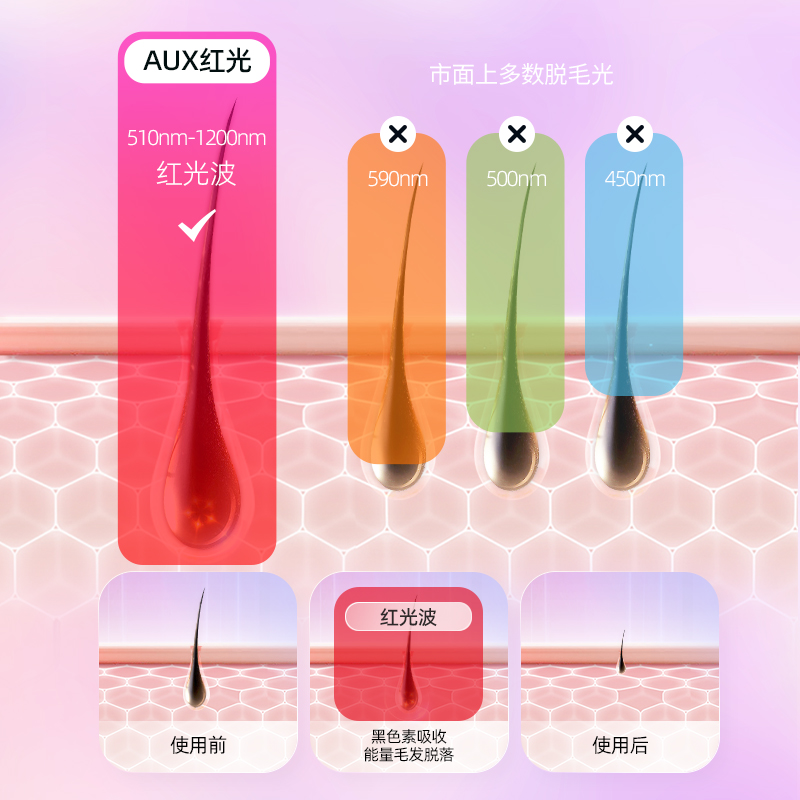 奥克斯红光波冰点脱毛仪器全身激光 奥克斯乐盈脱毛仪器