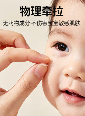 倒睫毛矫正贴儿童专用神器