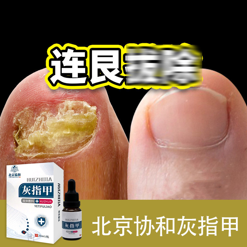  米亚尼保健用品膏药贴（器械）