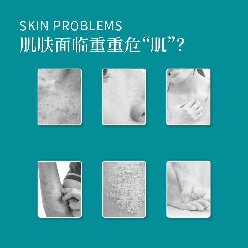 同仁堂皮肤干燥瘙痒全身痒喷雾剂 小禾诗蔓医疗器械保健理疗