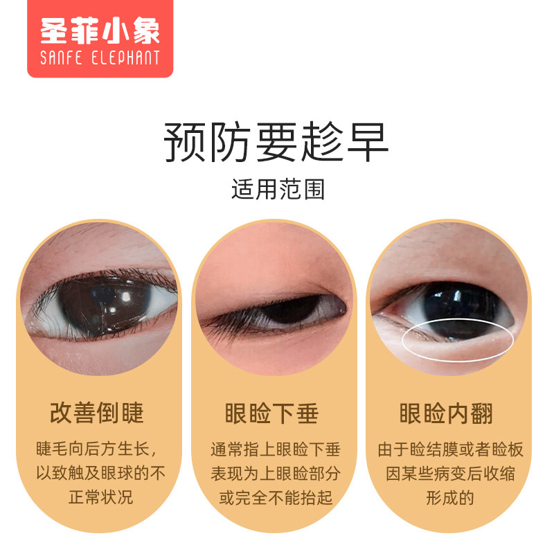 儿童倒睫毛矫正贴宝宝成人上下眼睑下垂胶带提拉眼皮贴婴倒睫神器,淘宝优惠券,粉丝福利购,淘宝优惠卷