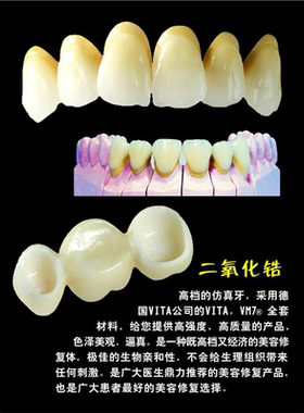 为了您和家人的健康请选择绿色修复海报二氧化锆全瓷精品全瓷牙