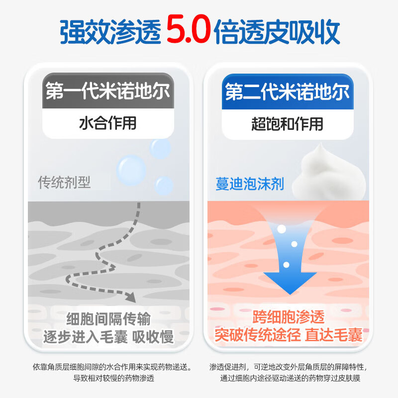 蔓迪米诺地尔泡沫剂60g*3瓶生发泡沫酊液男性型雄脱发官方旗舰店
