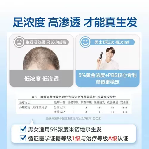 蔓迪 Спрей, лосьон для волос подходит для мужчин и женщин по линии роста волос, 90 мл, антиалопеция