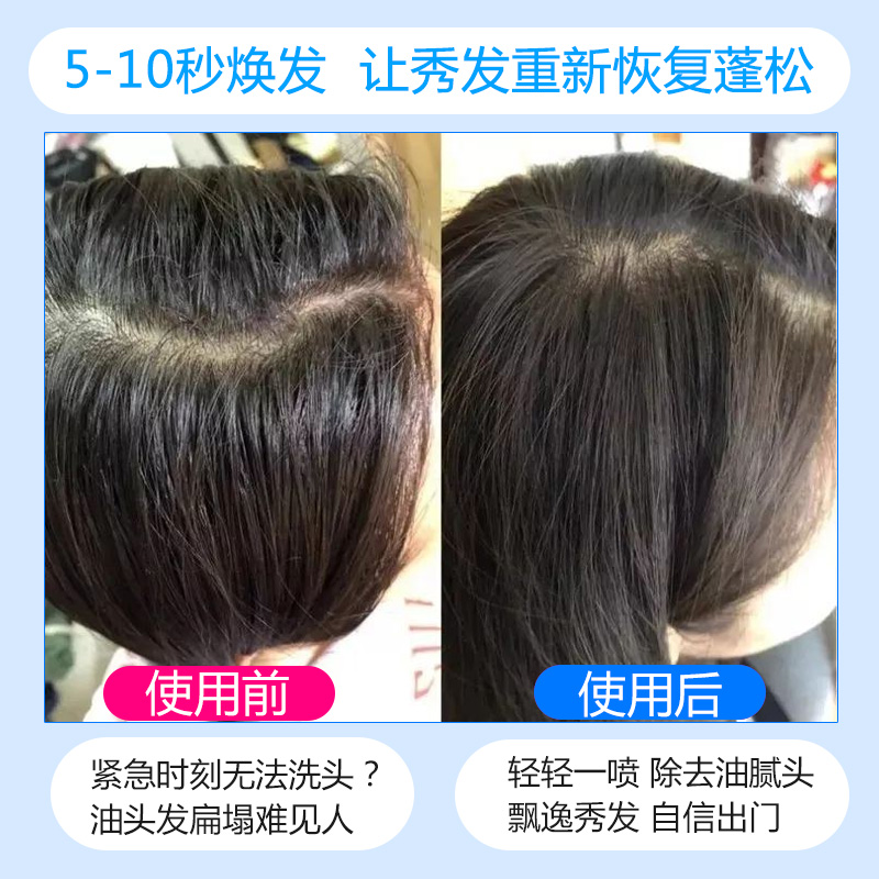 免洗干洗干发喷雾懒人免水洗发水去油头发神器蓬松坐月子产妇男女 - 图0
