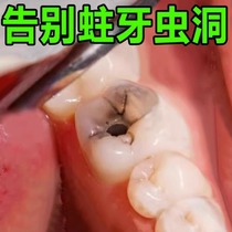 (Dental Identical) Farewell Tooth Decay Wormhole Tooth Black Caveat Tooth Decay Tooth Repair Tooth Cave Yourself BAD TOOTH