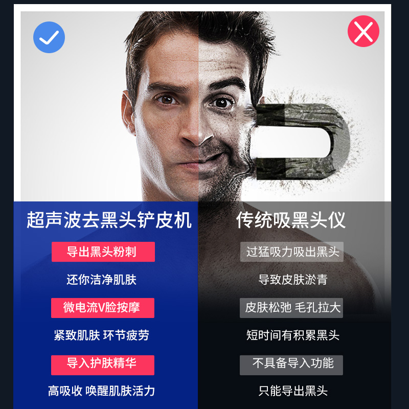 法国vlvee去黑头粉刺神器黑头铲 vlvee电子美容仪