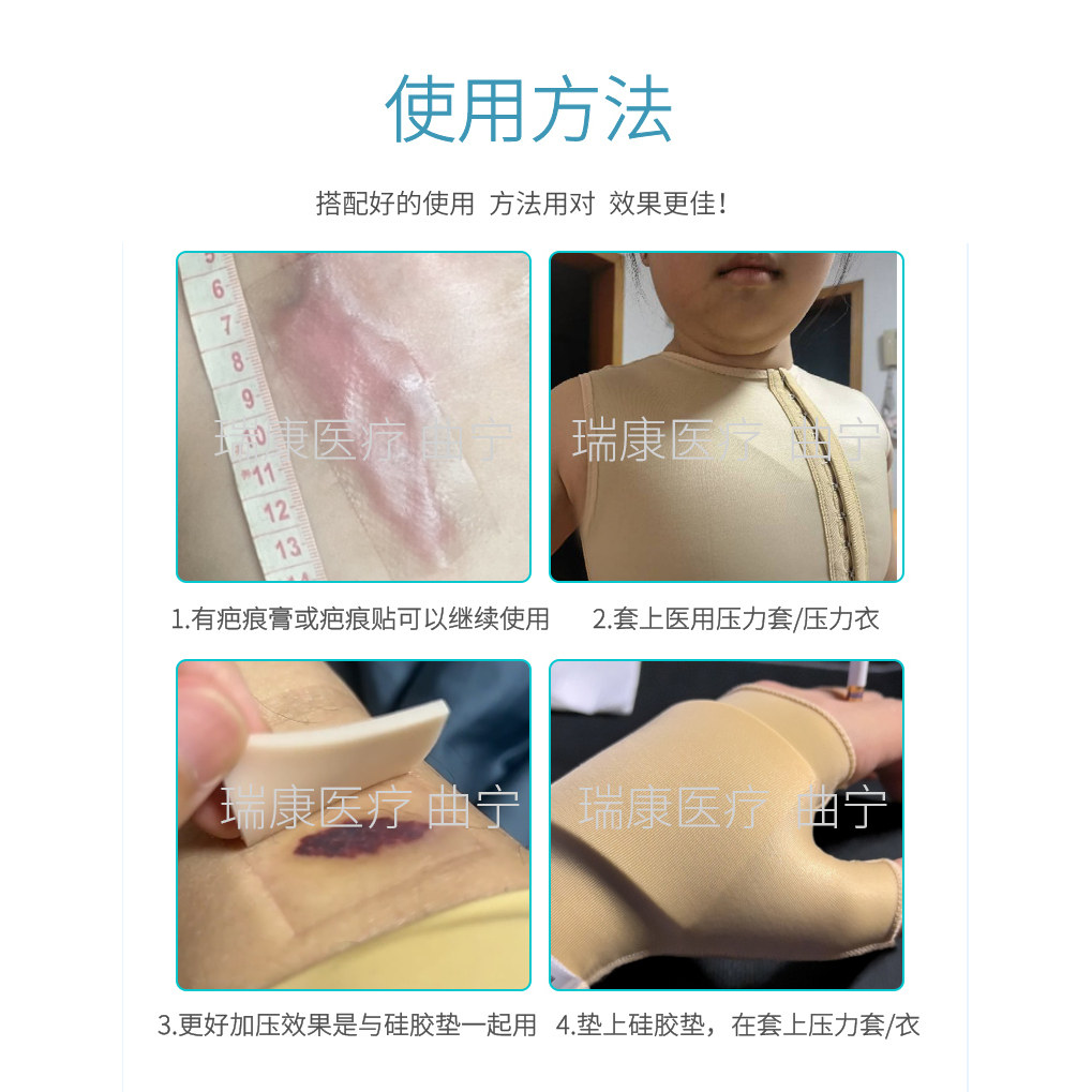 曲宁医用弹力手套胳膊臂套疤痕增生加压烧烫伤压力套防增生,淘宝优惠券,粉丝福利购,淘宝优惠卷