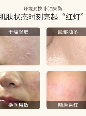 伊夏洋甘菊保湿喷雾补水定妆滋润保湿护肤水爽肤水化妆水日常补水
