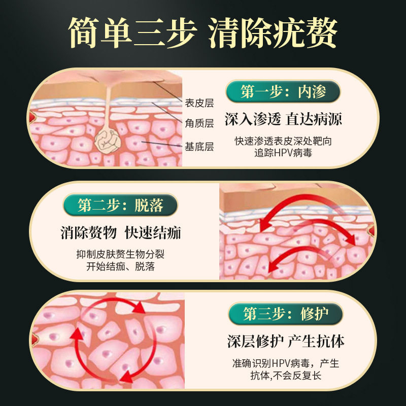 扁平疣可搭去除膏专用面部跖疣去丝状颈部寻常疣瘊子净疣灵药房_虎窝淘
