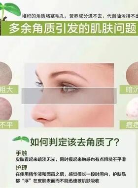 【假一赔十】芦荟胶去角质啫喱深层清洁去黑头去粗糙死皮光滑肌肤