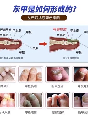灰指甲打磨机器电动硬脚