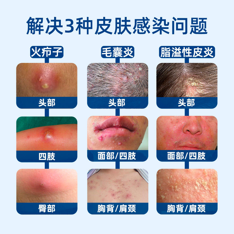  硬核医生医药皮脂汗腺