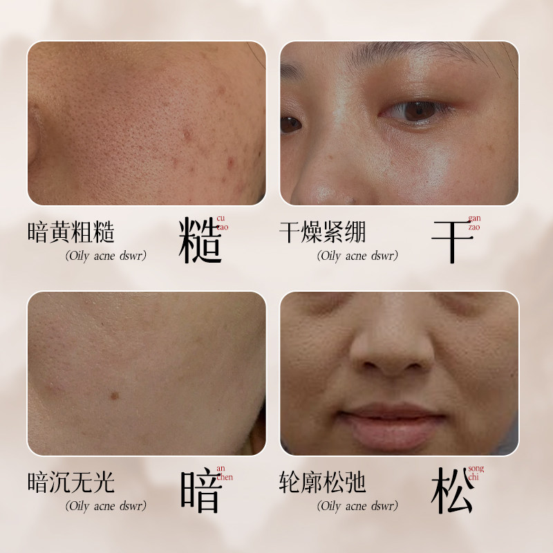 美白祛斑修护面膜熬夜改善暗沉提亮肤色修护贴片面膜,淘宝优惠券,粉丝福利购,淘宝优惠卷