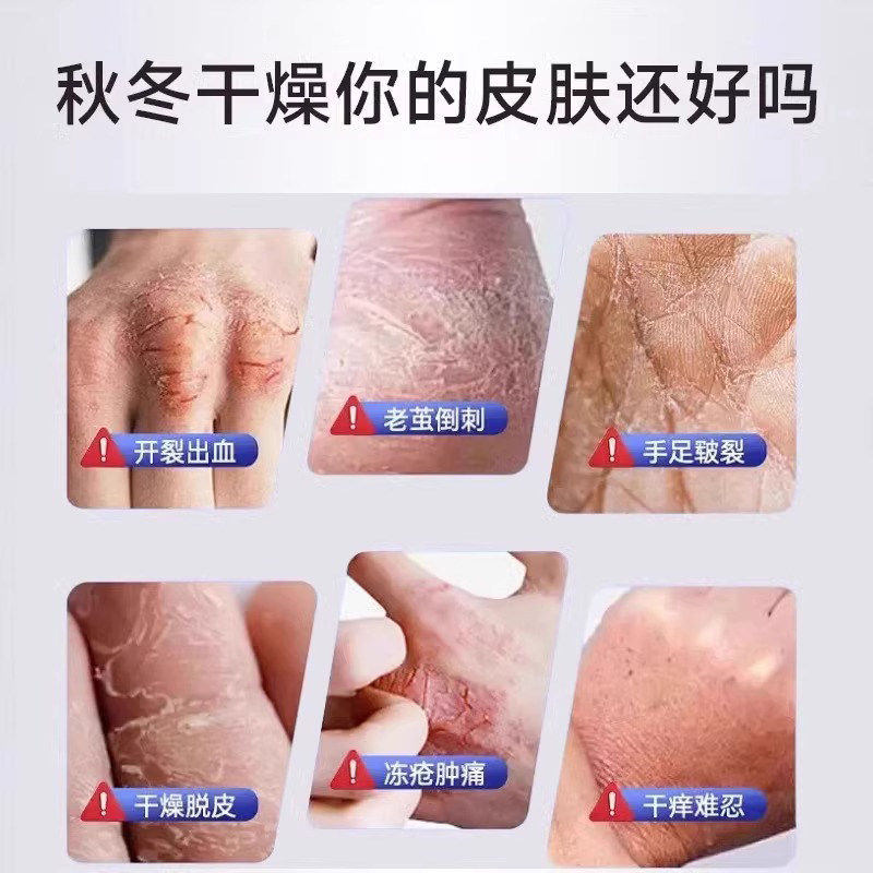 香港时珍大药房医用聚乙二醇皲裂膏官方旗舰店正品保障6gm,淘宝优惠券,粉丝福利购,淘宝优惠卷